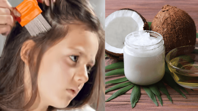 Effective Home Remedies and Precautions for Head Lice Infestation..!
