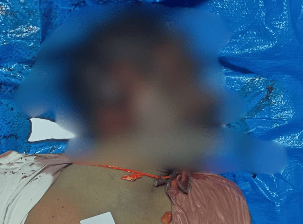 Man Brutally Killed with Hammer in Varthur!