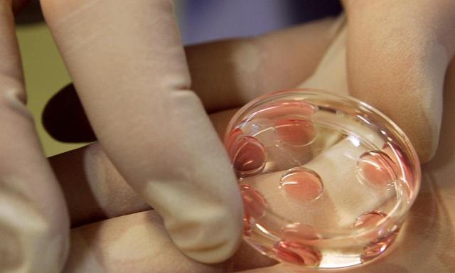 Rising Interest in Egg Freezing Among Professional Women! But why..?